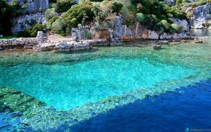 dental tourism Turkey
