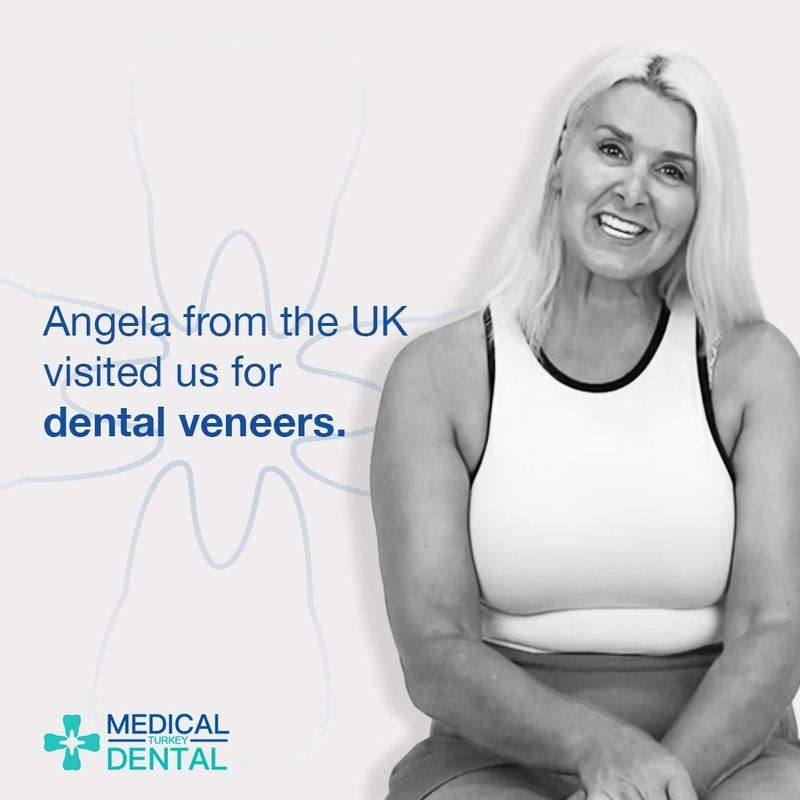 Angela from USA visited turkey and had a dental veneers