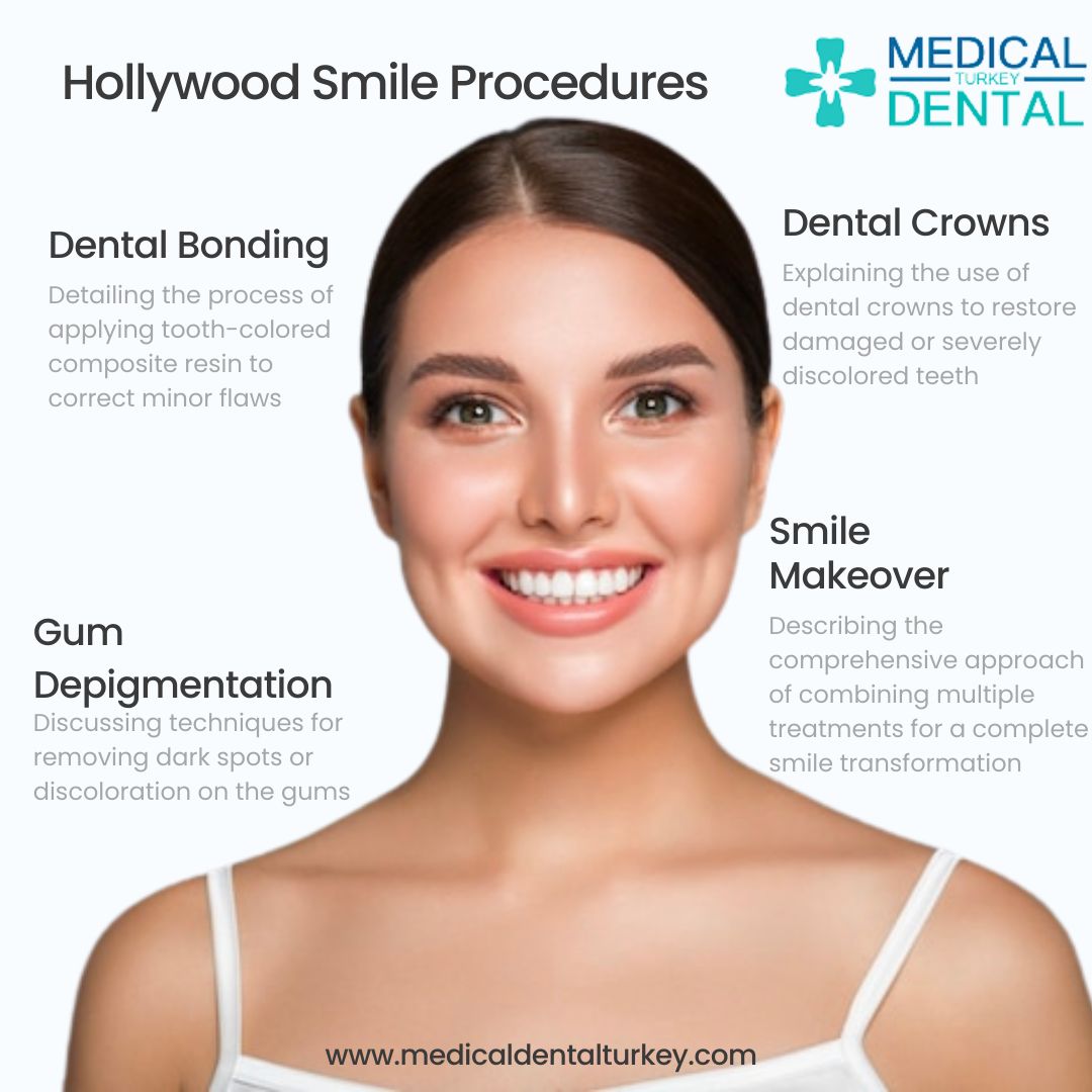 Hollywood Smile (Smile Makeover) Procedures Infographic: Hollywood Smile (Smile Makeover) Procedures