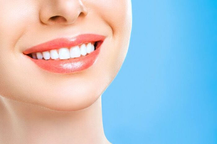 Hollywood Smile Cost Turkey-Smile Makeover,Design Antalya