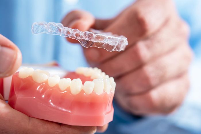 Invisalign in Antalya,Turkey