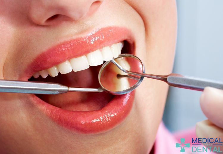 Sedation Anesthesia photo in turkey